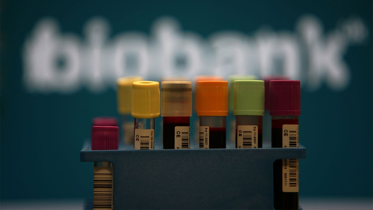 Blood samples given to the Biobank of the United Kingdom