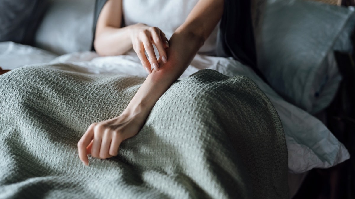 Itching woman rash