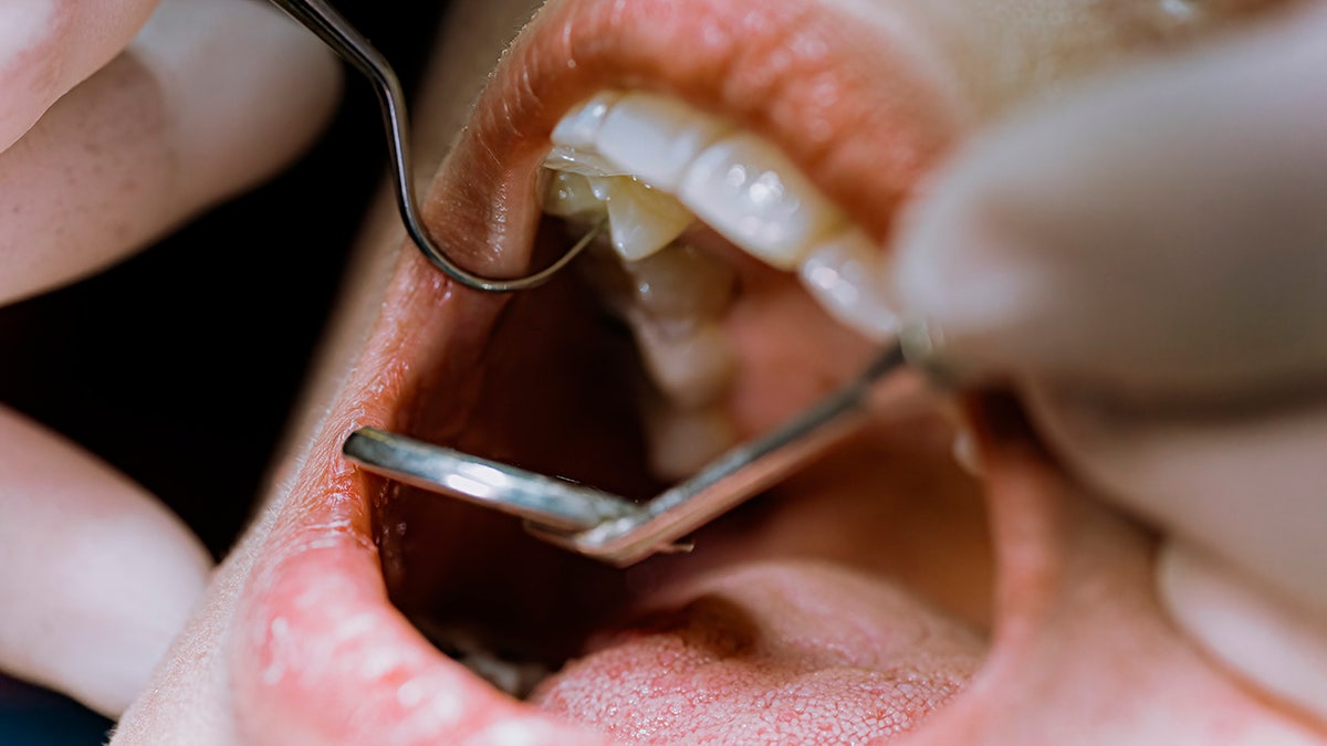 View very close to a dental exam, we see the mouth and the small hand mirror