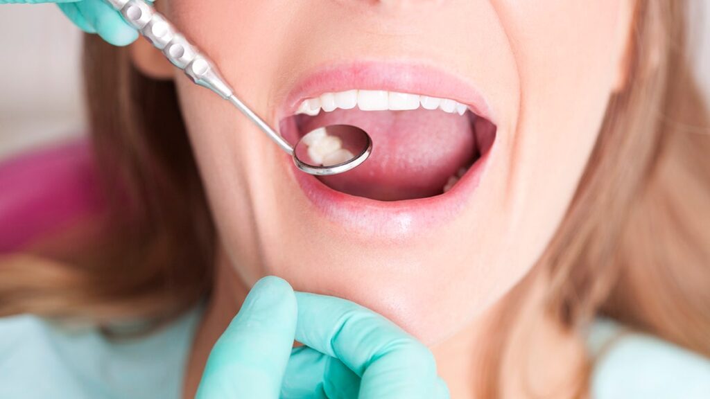 More common causes of cavities in the teeth and how to prevent