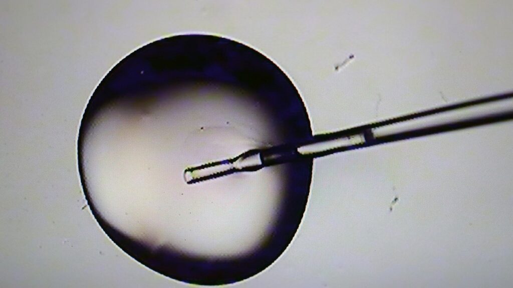 Rise of the Superbaby? The US startup offers IQ genetic screening for Wealthy Elite: Report