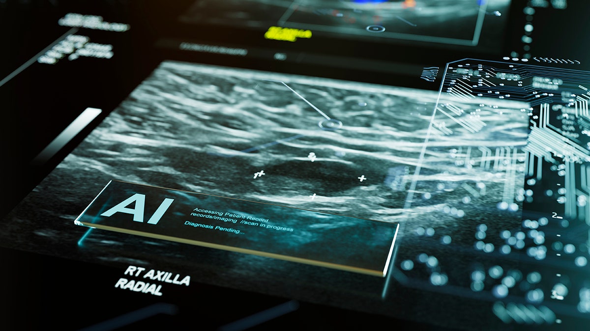 AI screening for breast cancer