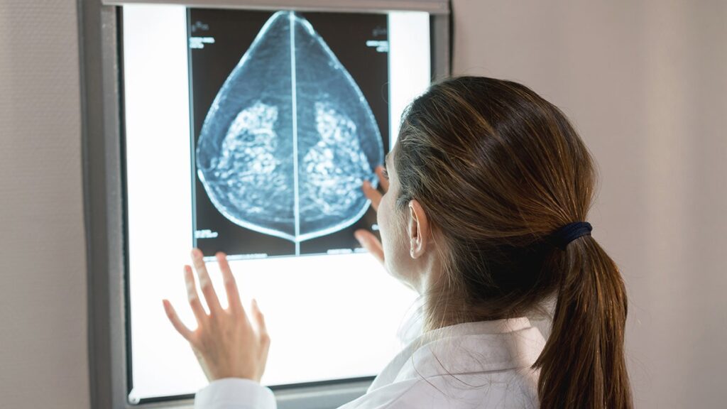 The FDA approves the first AI tool to predict the risk of breast cancer